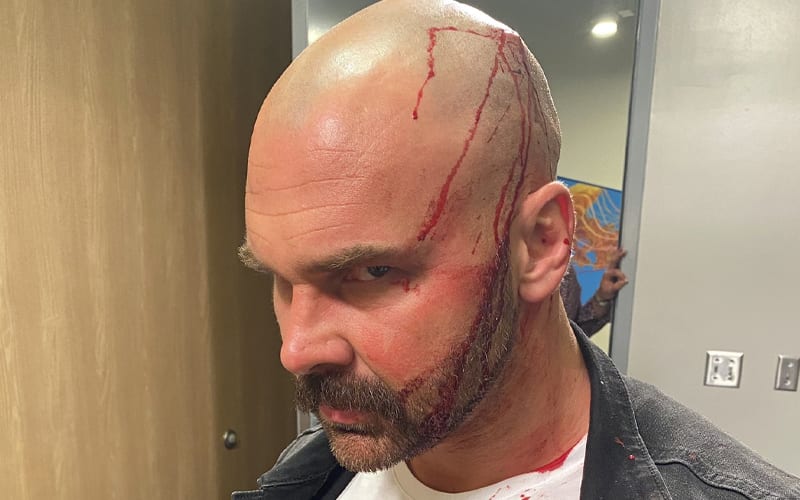 Dax Harwood Shows Off Gruesome Photos Of Bloody Head Injury After AEW